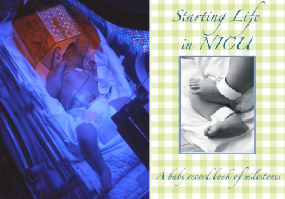 Starting Life In NICU
